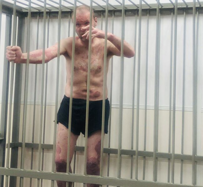 Инвалиду Андрею Шабанову позволили визит ревматолога в СИЗО