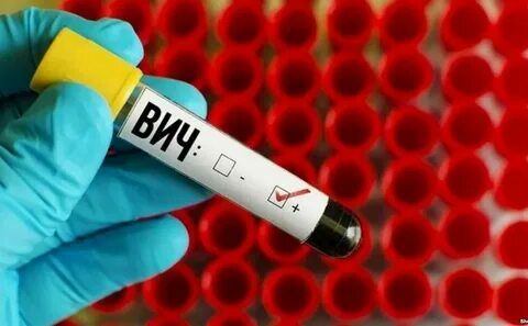 Самарская область в лидерах по заболеваемости ВИЧ